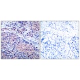 Immunohistochemistry - IkB-a (Ab-32/36) Antibody from Signalway Antibody (21122) - Antibodies.com