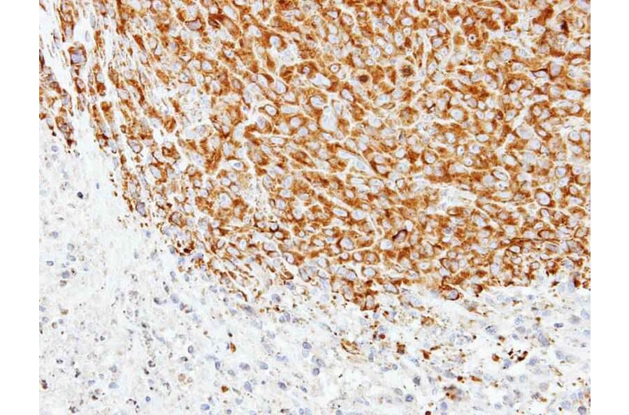 Immunohistochemistry - Tubulin alpha 1A antibody from Signalway Antibody (22015) - Antibodies.com