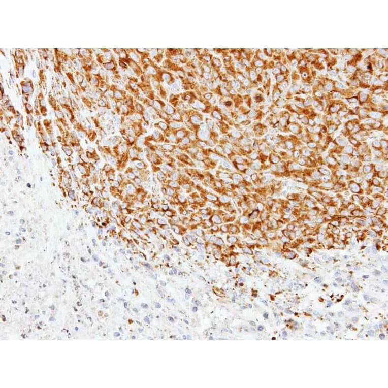 Immunohistochemistry - Tubulin alpha 1A antibody from Signalway Antibody (22015) - Antibodies.com