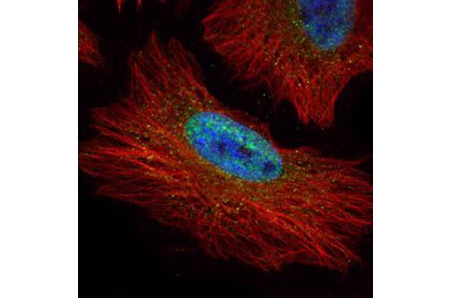 nucleoporin p62 antibody from Signalway Antibody (22064) - Antibodies.com