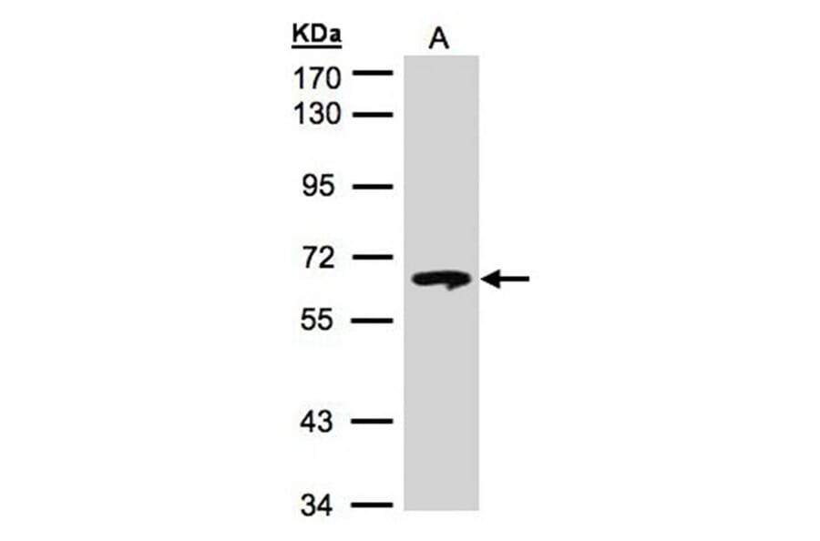 beta-glucosidase antibody from Signalway Antibody (22357) - Antibodies.com