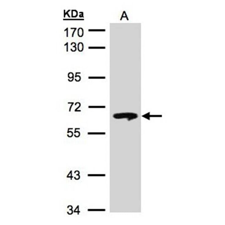 beta-glucosidase antibody from Signalway Antibody (22357) - Antibodies.com