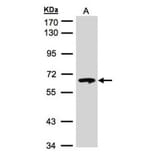 beta-glucosidase antibody from Signalway Antibody (22357) - Antibodies.com