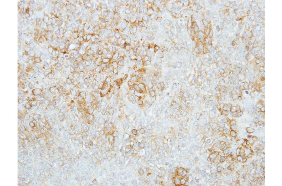 Immunohistochemistry - beta-glucosidase antibody from Signalway Antibody (22357) - Antibodies.com