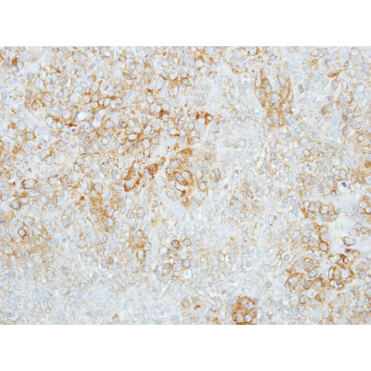 Immunohistochemistry - beta-glucosidase antibody from Signalway Antibody (22357) - Antibodies.com