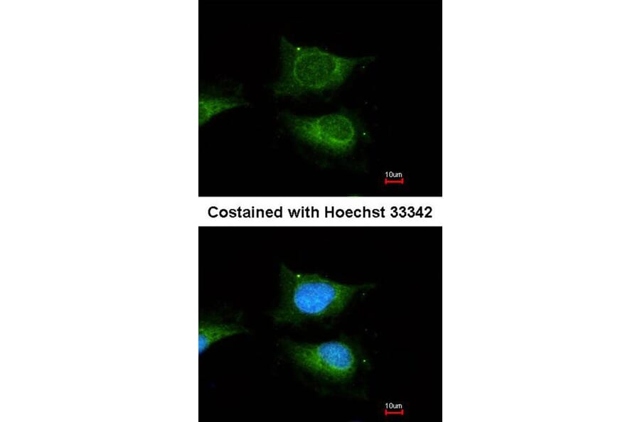 Immunofluorescence - beta-glucosidase antibody from Signalway Antibody (22357) - Antibodies.com