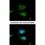Immunofluorescence - beta-glucosidase antibody from Signalway Antibody (22357) - Antibodies.com
