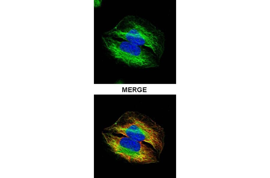 alpha Tubulin 4a antibody from Signalway Antibody (22537) - Antibodies.com