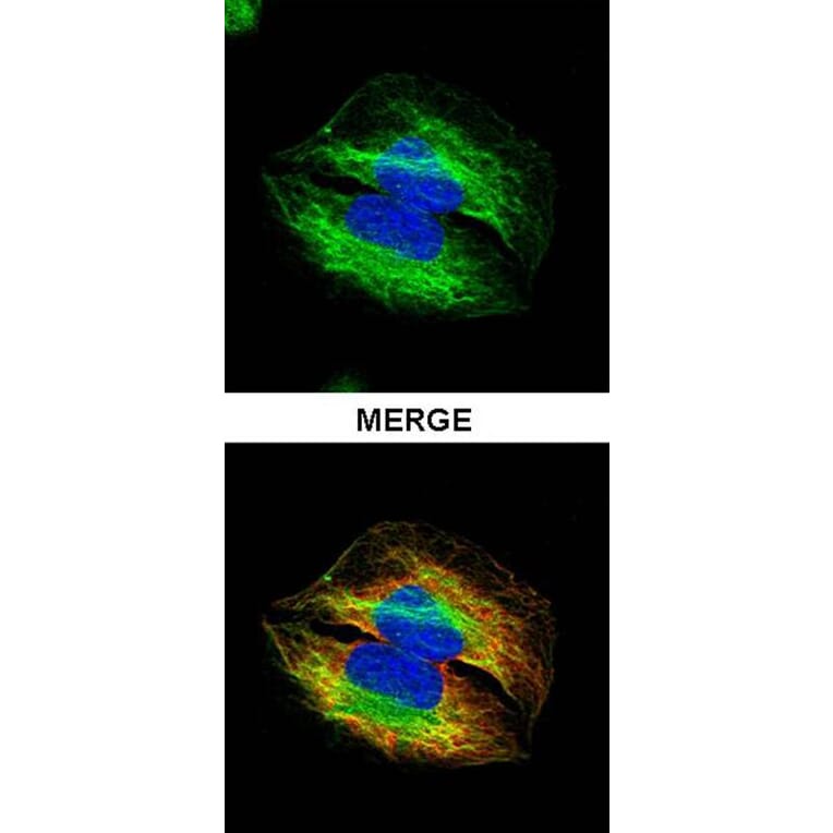 alpha Tubulin 4a antibody from Signalway Antibody (22537) - Antibodies.com
