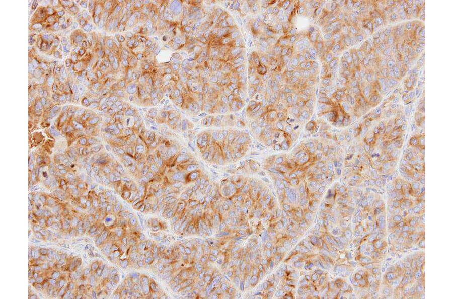 Immunohistochemistry - Tubulin alpha-1B antibody from Signalway Antibody (23103) - Antibodies.com