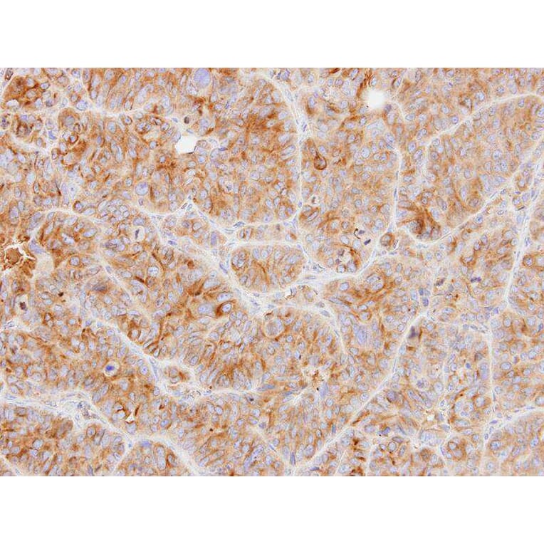 Immunohistochemistry - Tubulin alpha-1B antibody from Signalway Antibody (23103) - Antibodies.com