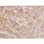 Immunohistochemistry - Tubulin alpha-1B antibody from Signalway Antibody (23103) - Antibodies.com