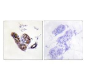 Immunohistochemistry - MITF (Ab-180/73) Antibody from Signalway Antibody (33138) - Antibodies.com