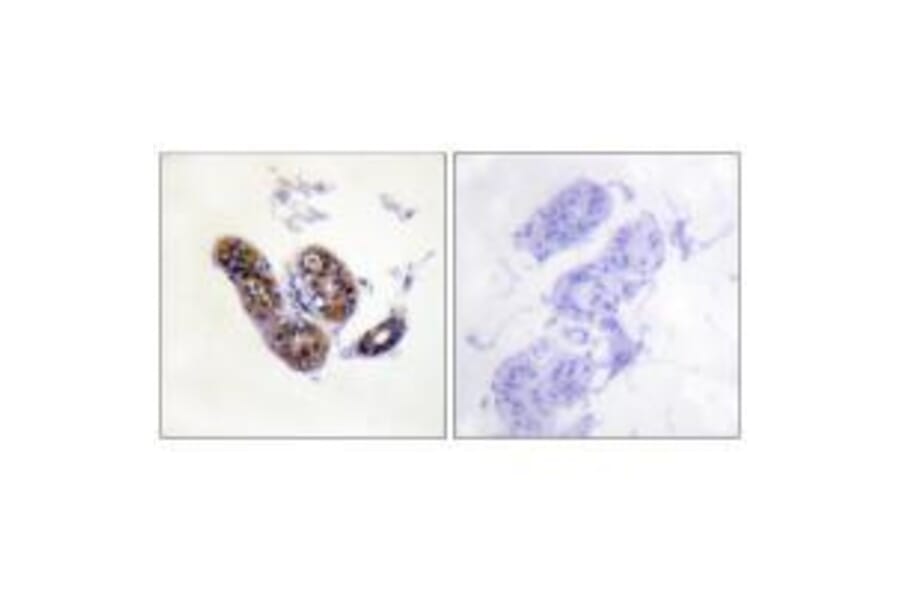 Immunohistochemistry - MITF (Ab-180/73) Antibody from Signalway Antibody (33138) - Antibodies.com