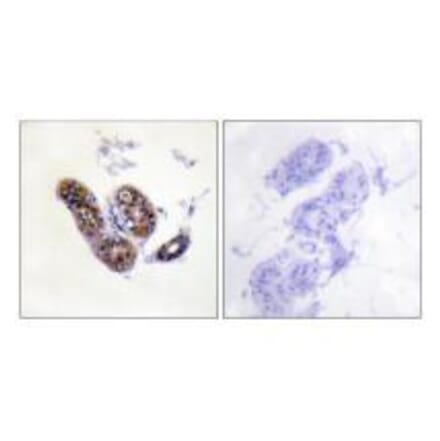Immunohistochemistry - MITF (Ab-180/73) Antibody from Signalway Antibody (33138) - Antibodies.com