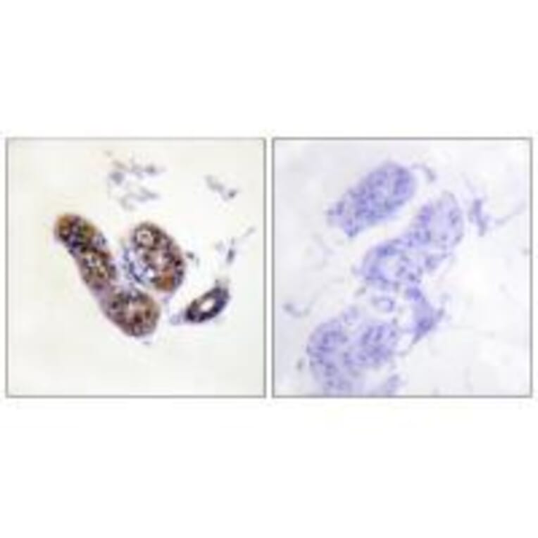 Immunohistochemistry - MITF (Ab-180/73) Antibody from Signalway Antibody (33138) - Antibodies.com