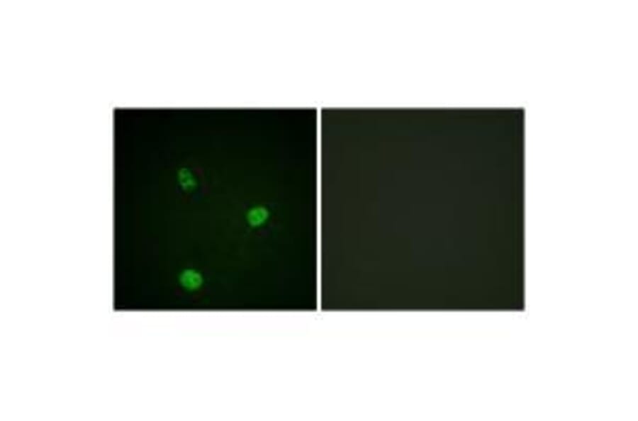 Immunofluorescence - MITF (Ab-180/73) Antibody from Signalway Antibody (33138) - Antibodies.com