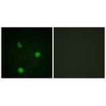 Immunofluorescence - MITF (Ab-180/73) Antibody from Signalway Antibody (33138) - Antibodies.com