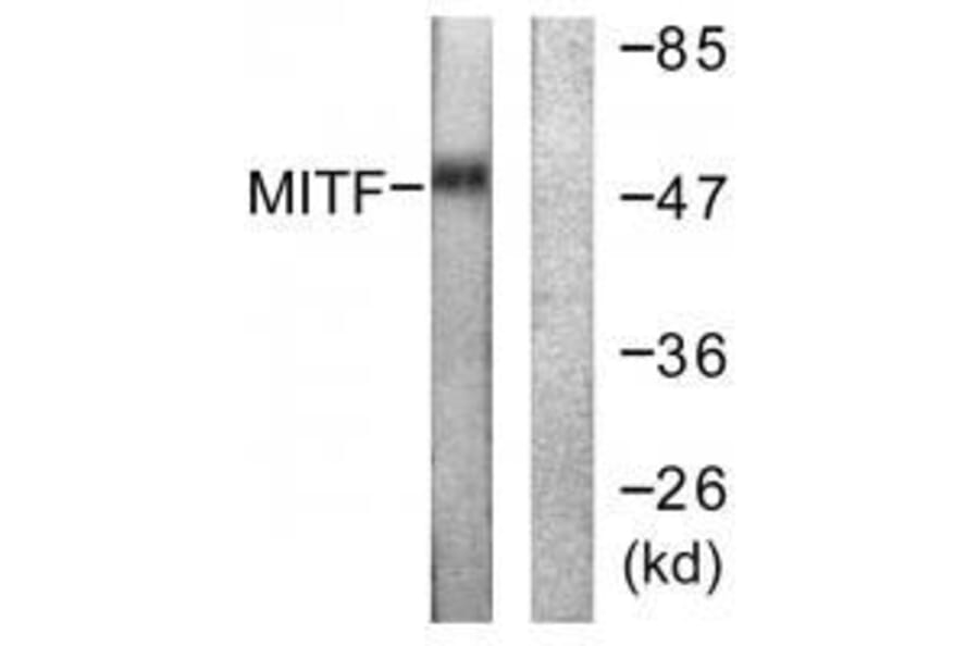 Western blot - MITF (Ab-180/73) Antibody from Signalway Antibody (33138) - Antibodies.com