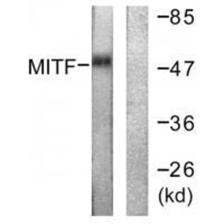 Western blot - MITF (Ab-180/73) Antibody from Signalway Antibody (33138) - Antibodies.com