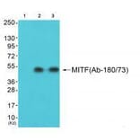 Western blot - MITF (Ab-180/73) Antibody from Signalway Antibody (33138) - Antibodies.com