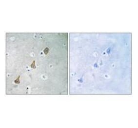 Immunohistochemistry - PECAM-1 (Ab-713) Antibody from Signalway Antibody (33141) - Antibodies.com