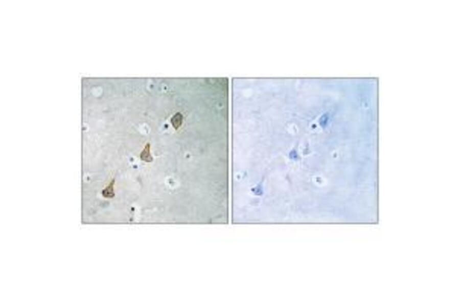Immunohistochemistry - PECAM-1 (Ab-713) Antibody from Signalway Antibody (33141) - Antibodies.com