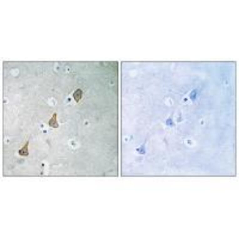 Immunohistochemistry - PECAM-1 (Ab-713) Antibody from Signalway Antibody (33141) - Antibodies.com