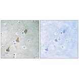 Immunohistochemistry - PECAM-1 (Ab-713) Antibody from Signalway Antibody (33141) - Antibodies.com