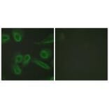 Immunofluorescence - PECAM-1 (Ab-713) Antibody from Signalway Antibody (33141) - Antibodies.com