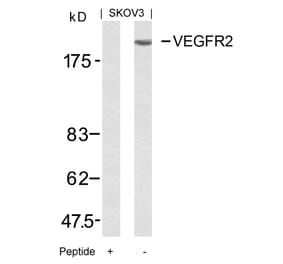 Western blot - VEGFR2 (Ab-951) Antibody from Signalway Antibody (21079) - Antibodies.com