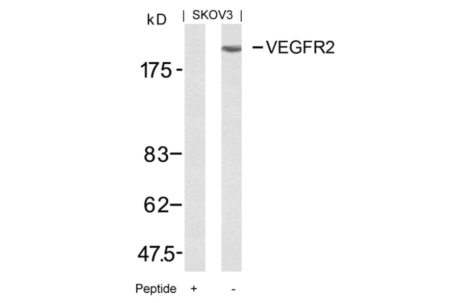 Western blot - VEGFR2 (Ab-951) Antibody from Signalway Antibody (21079) - Antibodies.com