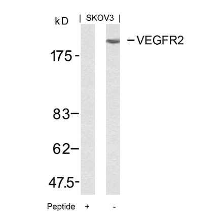 Western blot - VEGFR2 (Ab-951) Antibody from Signalway Antibody (21079) - Antibodies.com