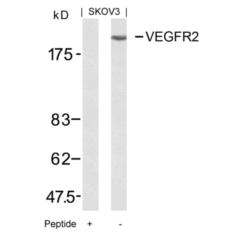 Western blot - VEGFR2 (Ab-951) Antibody from Signalway Antibody (21079) - Antibodies.com