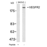 Western blot - VEGFR2 (Ab-951) Antibody from Signalway Antibody (21079) - Antibodies.com