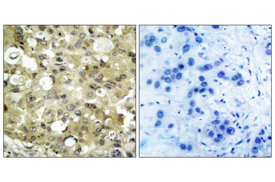 Immunohistochemistry - VEGFR2 (Ab-951) Antibody from Signalway Antibody (21079) - Antibodies.com