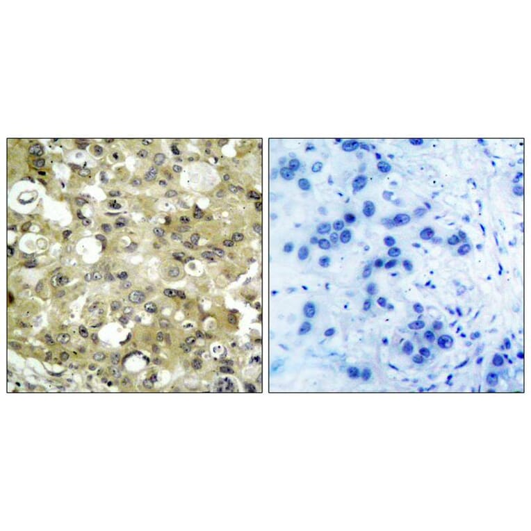 Immunohistochemistry - VEGFR2 (Ab-951) Antibody from Signalway Antibody (21079) - Antibodies.com