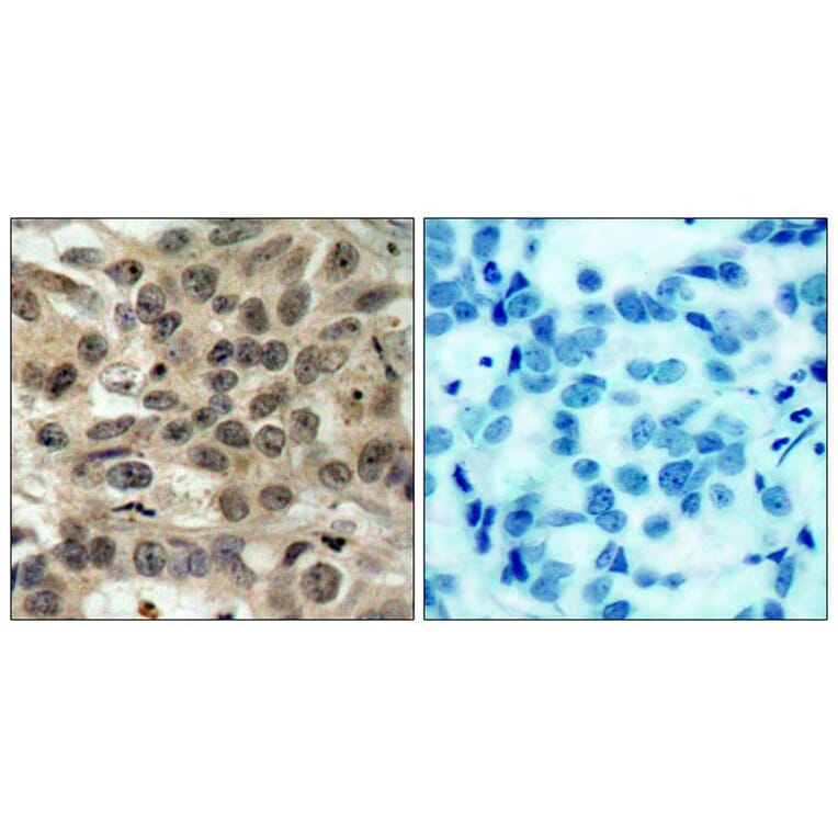 Immunohistochemistry - cdc25C (Ab-216) Antibody from Signalway Antibody (21145) - Antibodies.com