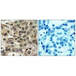 Immunohistochemistry - cdc25C (Ab-216) Antibody from Signalway Antibody (21145) - Antibodies.com