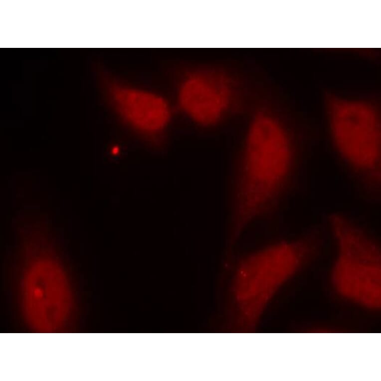 Immunofluorescence - cdc25C (Ab-216) Antibody from Signalway Antibody (21145) - Antibodies.com