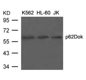 Western blot - p62Dok (Ab-398) Antibody from Signalway Antibody (21269) - Antibodies.com