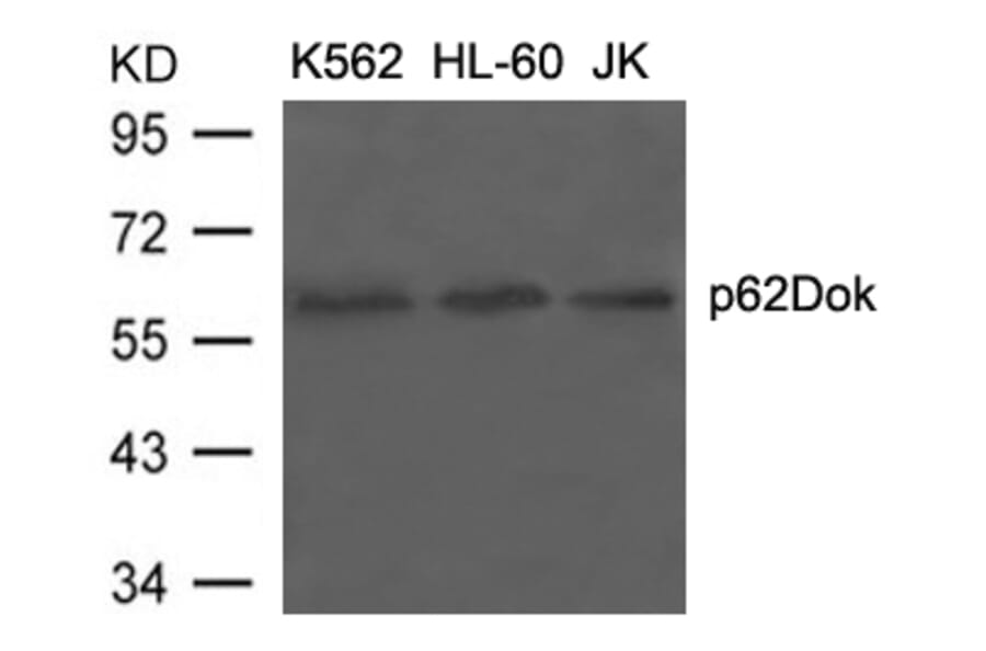 Western blot - p62Dok (Ab-398) Antibody from Signalway Antibody (21269) - Antibodies.com