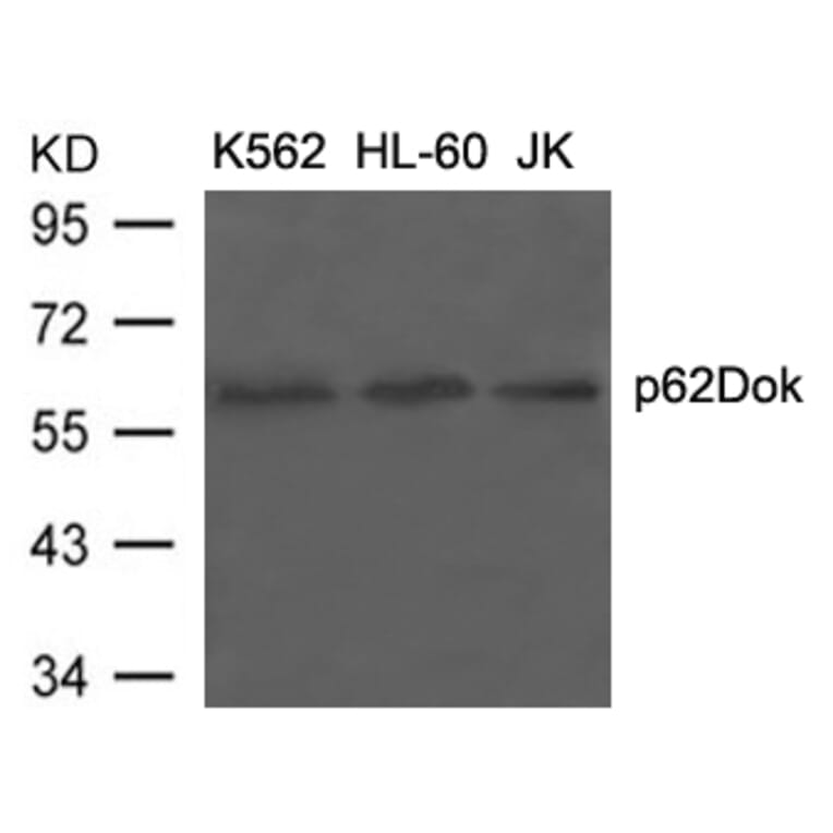 Western blot - p62Dok (Ab-398) Antibody from Signalway Antibody (21269) - Antibodies.com