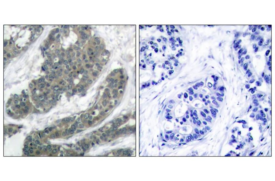 Immunohistochemistry - p62Dok (Ab-398) Antibody from Signalway Antibody (21269) - Antibodies.com