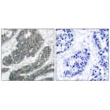 Immunohistochemistry - p62Dok (Ab-398) Antibody from Signalway Antibody (21269) - Antibodies.com