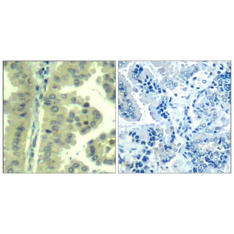 Immunohistochemistry - eIF4G (Ab-1232) Antibody from Signalway Antibody (21514) - Antibodies.com