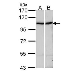 alpha Actinin 4 antibody from Signalway Antibody (22593) - Antibodies.com