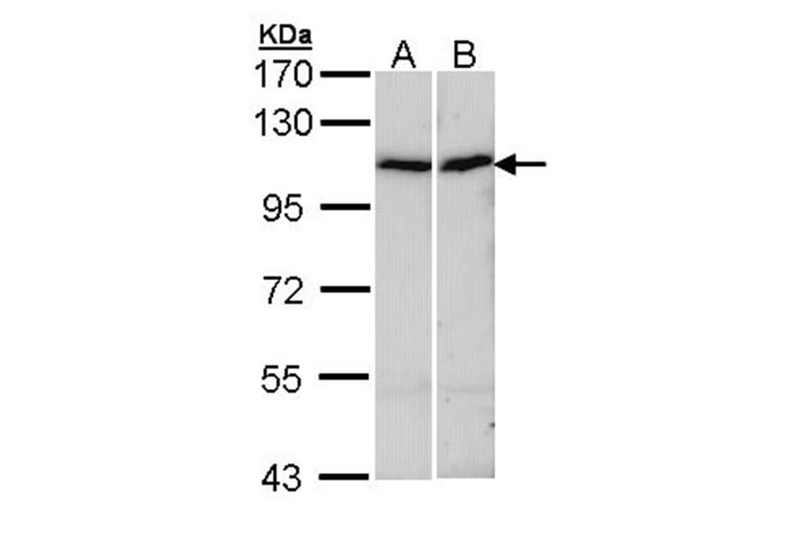 alpha Actinin 4 antibody from Signalway Antibody (22593) - Antibodies.com