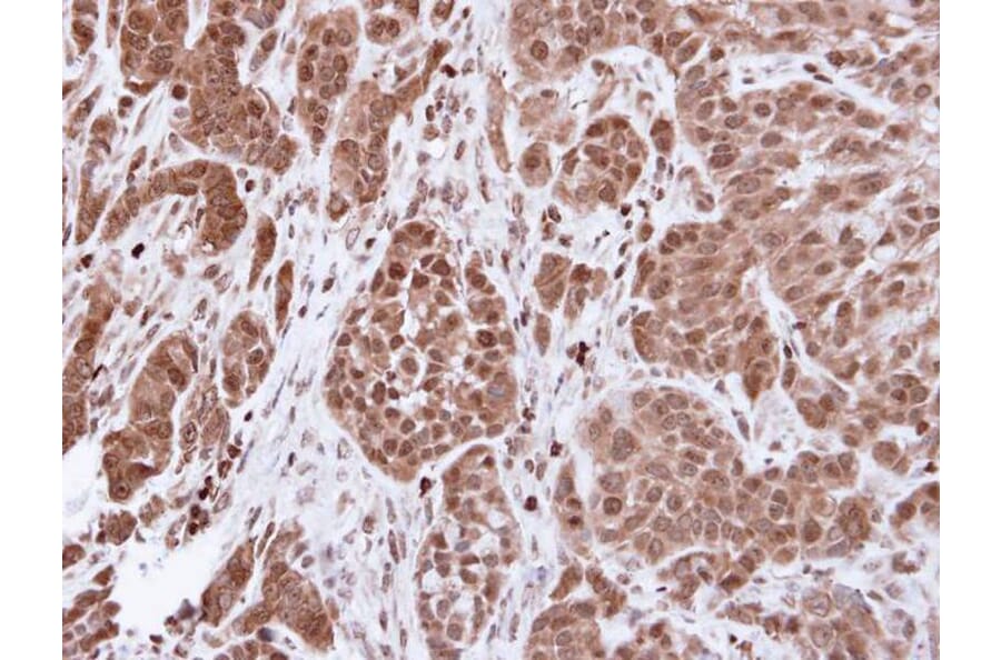 Immunohistochemistry - alpha Actinin 4 antibody from Signalway Antibody (22593) - Antibodies.com