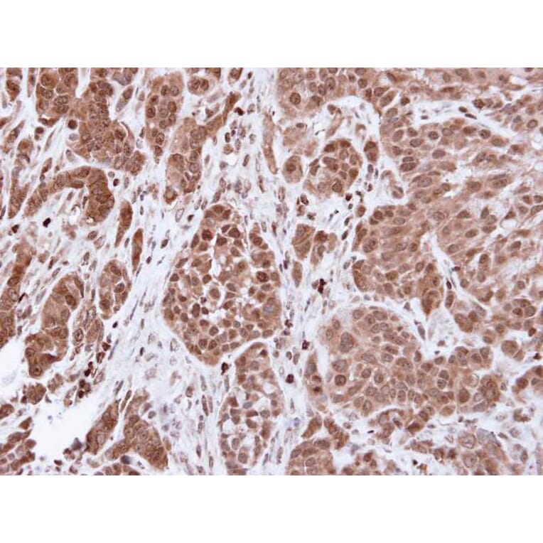 Immunohistochemistry - alpha Actinin 4 antibody from Signalway Antibody (22593) - Antibodies.com